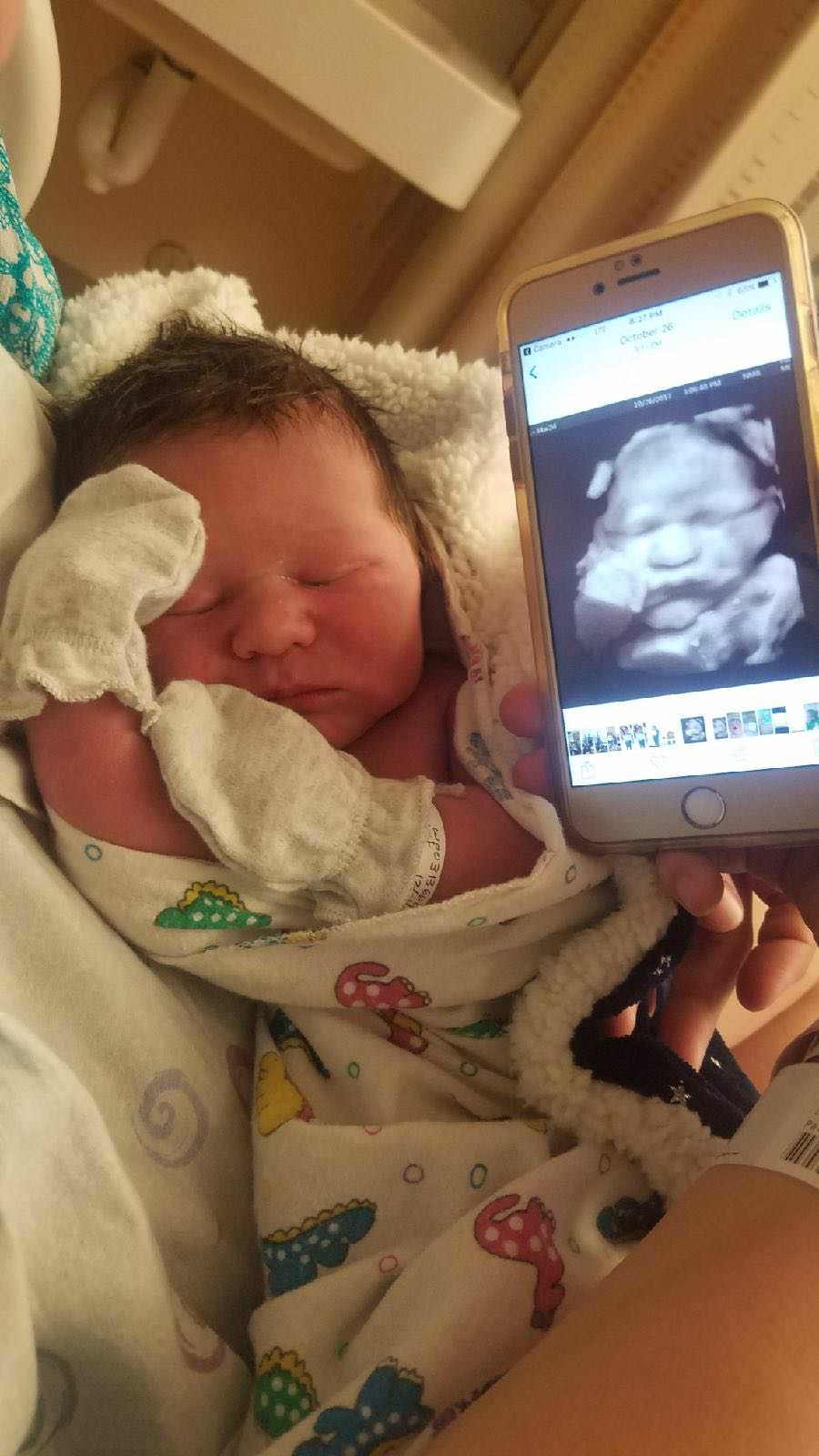 baby 3d ultrasound